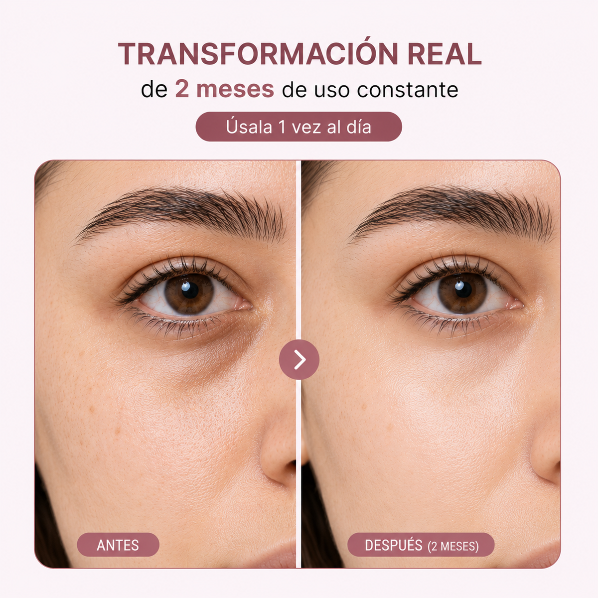 Parches de Ojos PDRN Pink Caffein Collagen Medicube